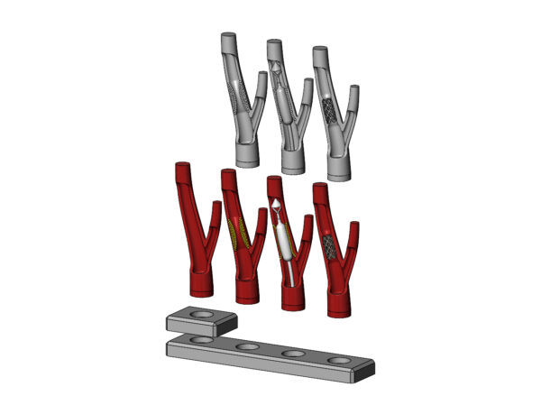 Procedimento de Implante de Stent de Artéria Carótida - Modelo 3D - Image 3